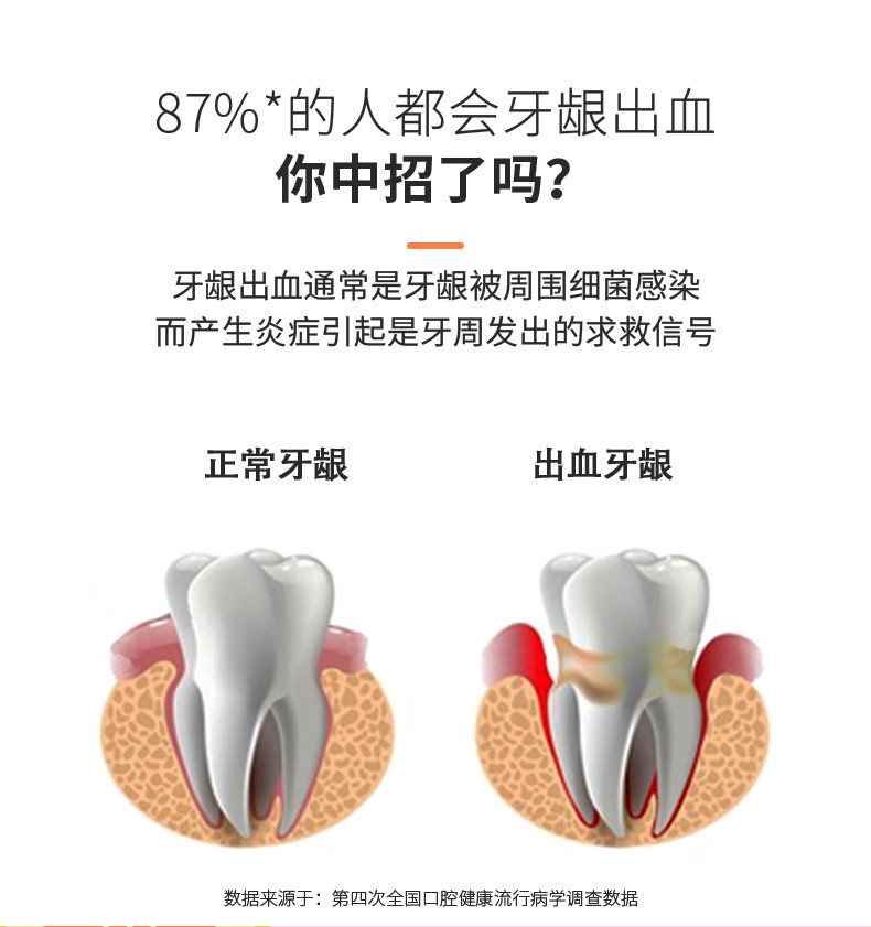 舒客(Saky) 舒客牙膏维C养护牙膏120g*4套装去口臭去牙渍清新口气去黄