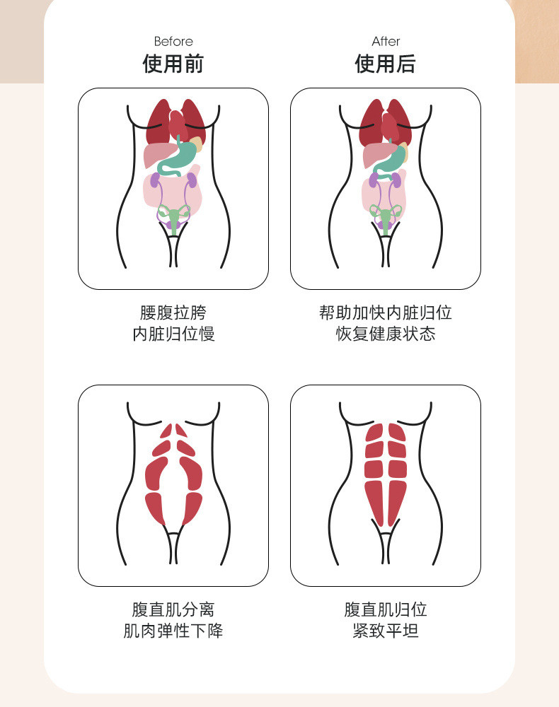 摩登孕妈 产后收腹带修复专用夏季薄款盆骨带腹带束腰矫正带纱布嫚三件套