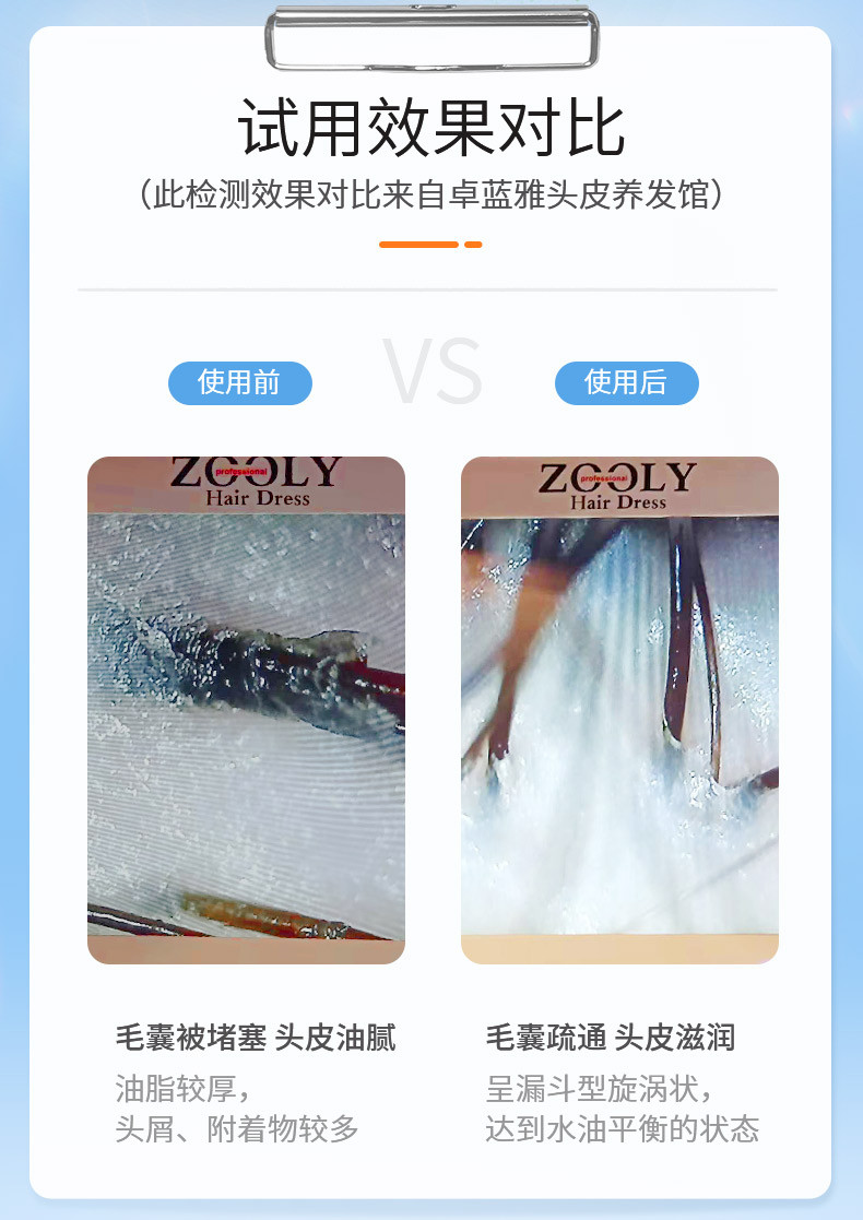 卓蓝雅(ZOOLY)生姜植萃清凉止痒去头皮角质平衡油脂清洁头皮 生姜头皮按摩膏300ml