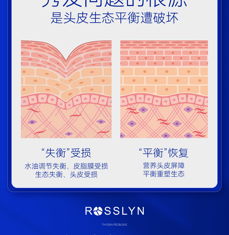 ROSSLYN 罗斯琳洗发水控油蓬松