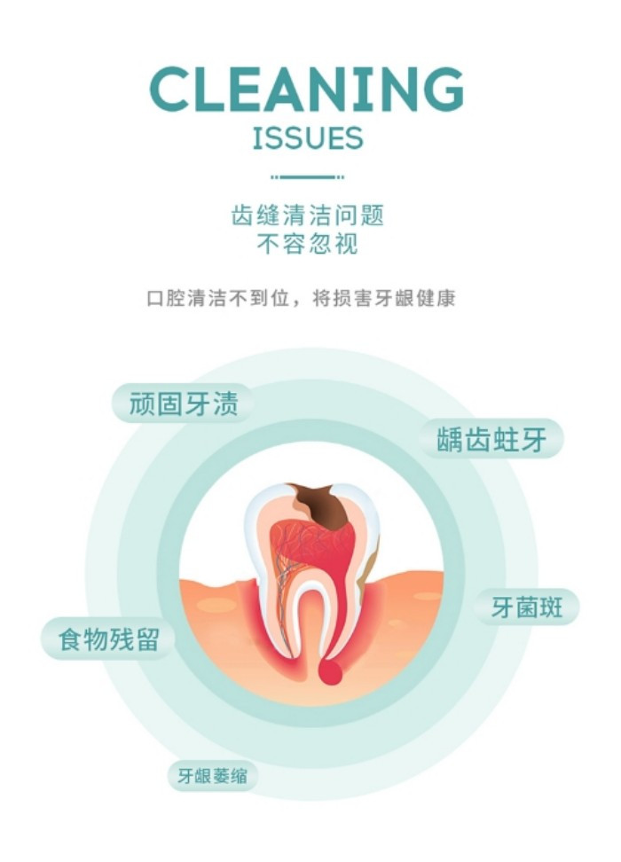 米妍 米妍（meyarn）扁平微蜡护龈牙线