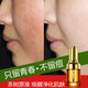 【邮乐濮阳】TQ梵西茶树原液男女祛痘印精华液正品 30ml