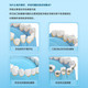 美的/MIDEA 美的冲牙器预防牙结石家用便携重力球专利MC-BJ0101