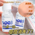 【3瓶】VSEA祛痘小粉水双酸温和修复淡化痘印闭口粉刺正品祛痘水